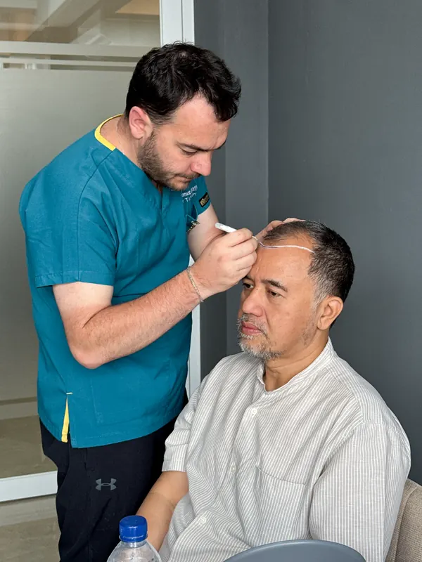 Dokter menggambar desain garis rambut baru pada dahi pasien